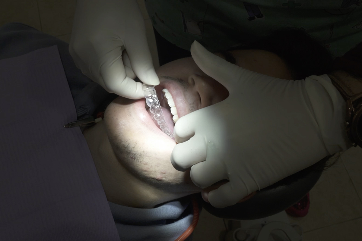 Importancia de la retención en la ortodoncia